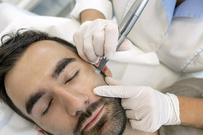 Peeling facial doctora cuadro medicina estetica